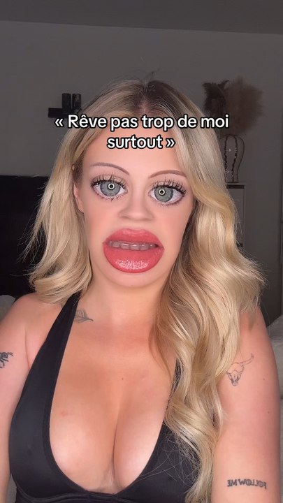 Omg