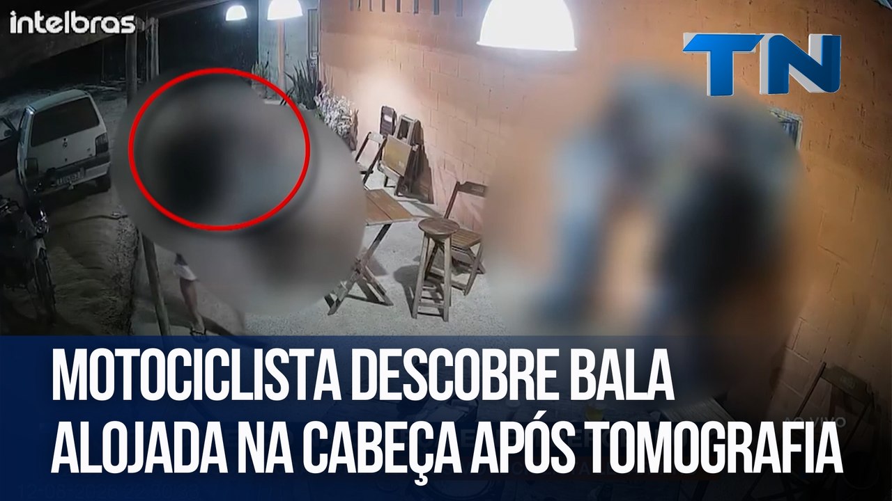 Motociclista descobre bala alojada na cabeça ap...