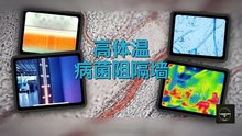 The 37°C Myth: Why Your 'Normal' Temperature Isn't Normal
