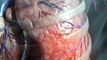 Ever wondered what actually happens inside your lungs when pneumonia strikes 😳