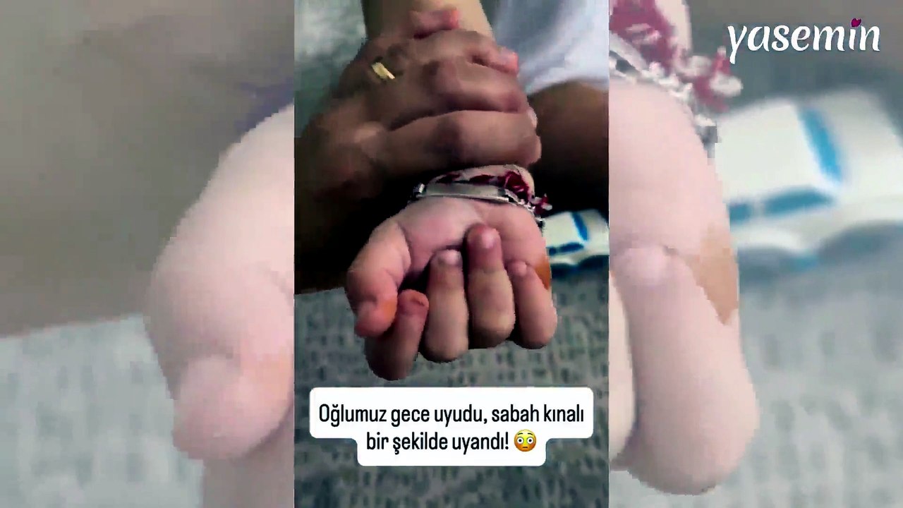 Sosyal medyada gündem oldu! Çocuğunun el ve aya...