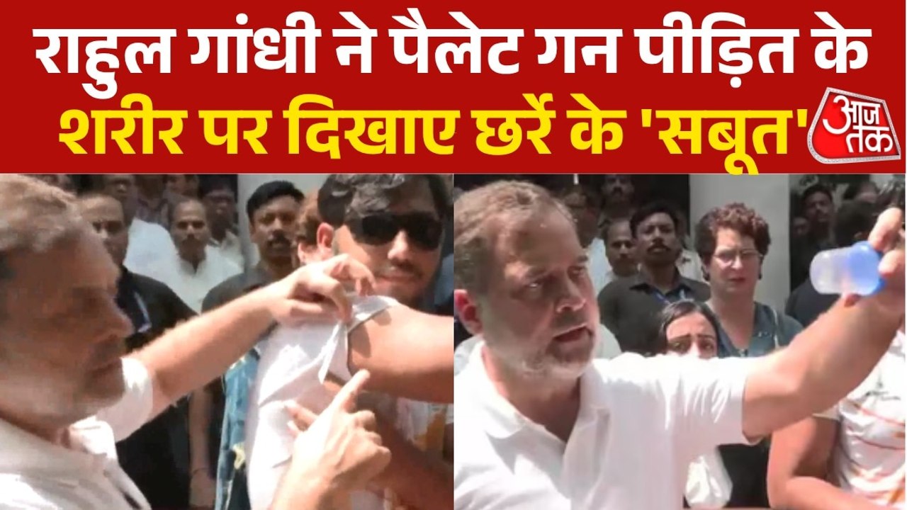 '200 इनके शरीर में हैं, 3 आंख में', राहुल गांधी...