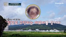 갱년기 이후 더 심해진 탈모! 가발 없이는 외출도 할 수 없다?!