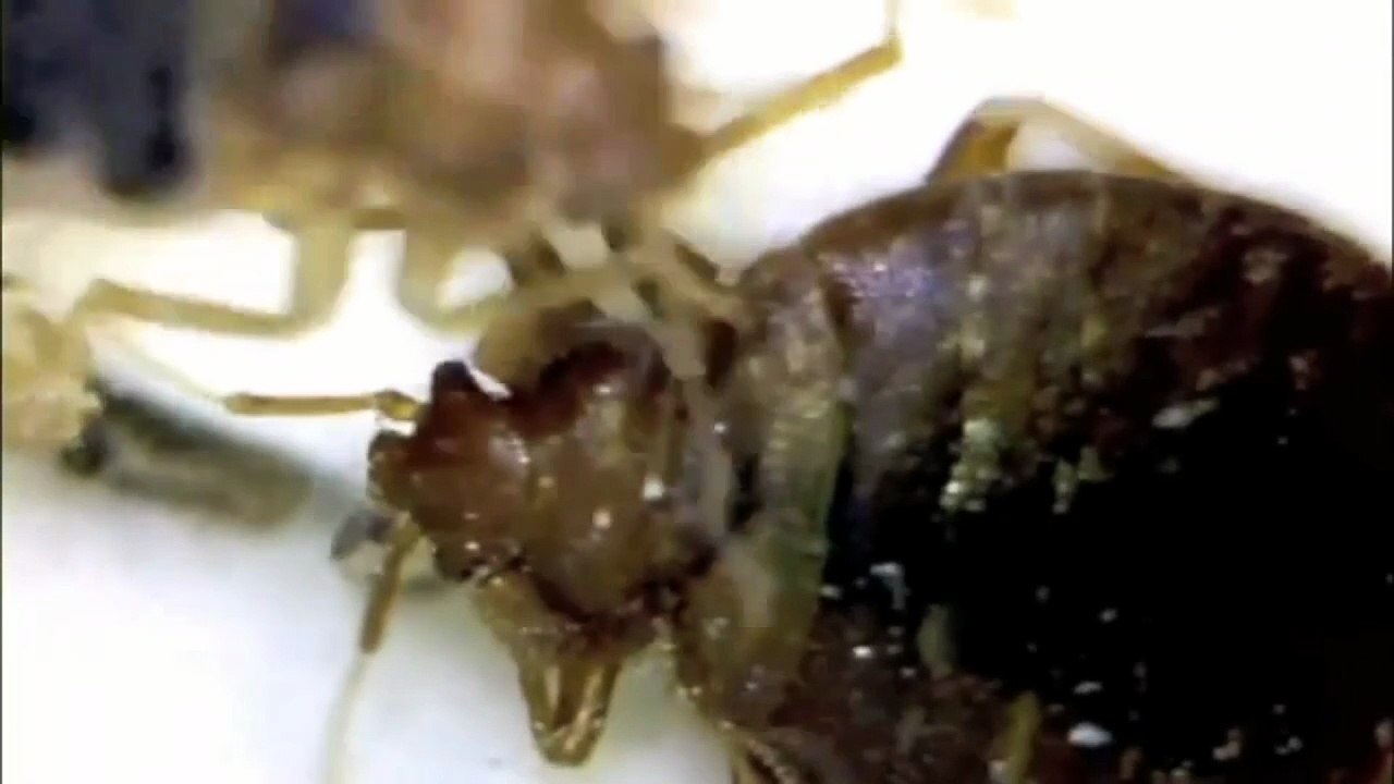 Do I have bed bugs or am I just itchy