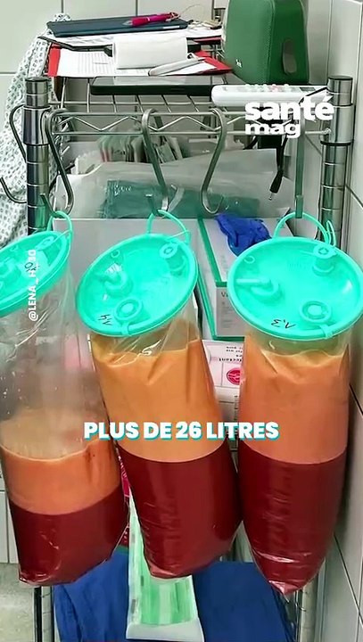 Je souffre de lipoedème