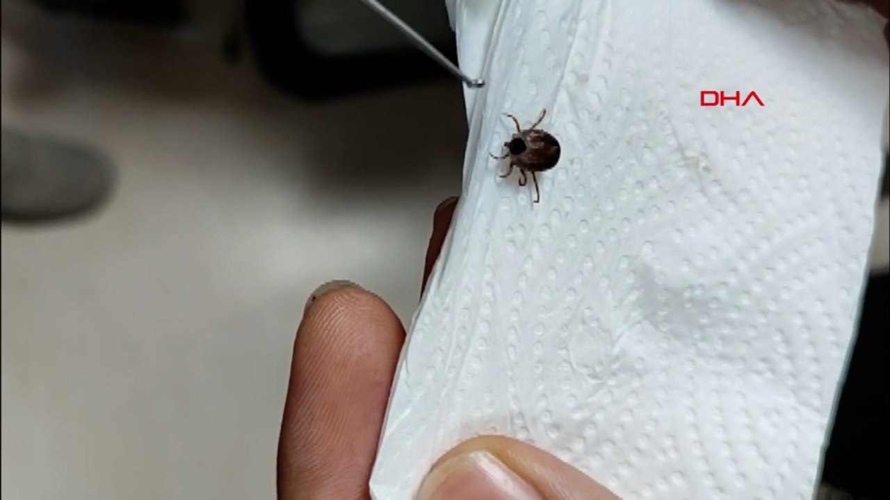 Çocuğun kulağından canlı kene çıkarıldı