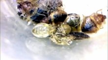 Are bed bugs due to poor hygiene