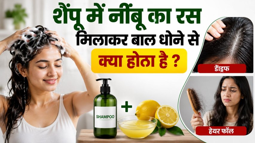 Hair Care Tips: Shampoo में नींबू मिलाकर बाल धोने से क्या सच में Dandruff कम होता है ? Expert Advice