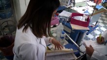 Síndrome de Turner puede estar presente desde el nacimiento sin diagnóstico