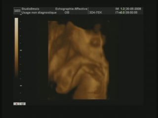 Soizig dans mon bidon :