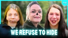 Living With The Rarest Facial Conditions | BORN DIFFERENT