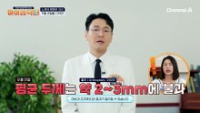 집안일 자세로 '무릎 관절염' 위기? 중년 여성을 노리는 관절염