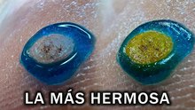¿Has visto una verruga así de bonita?