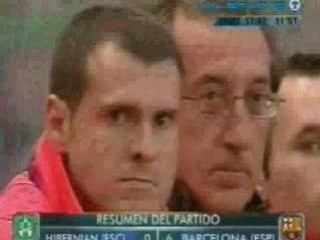 Hibernian FC - FC Barcelona (0-6)