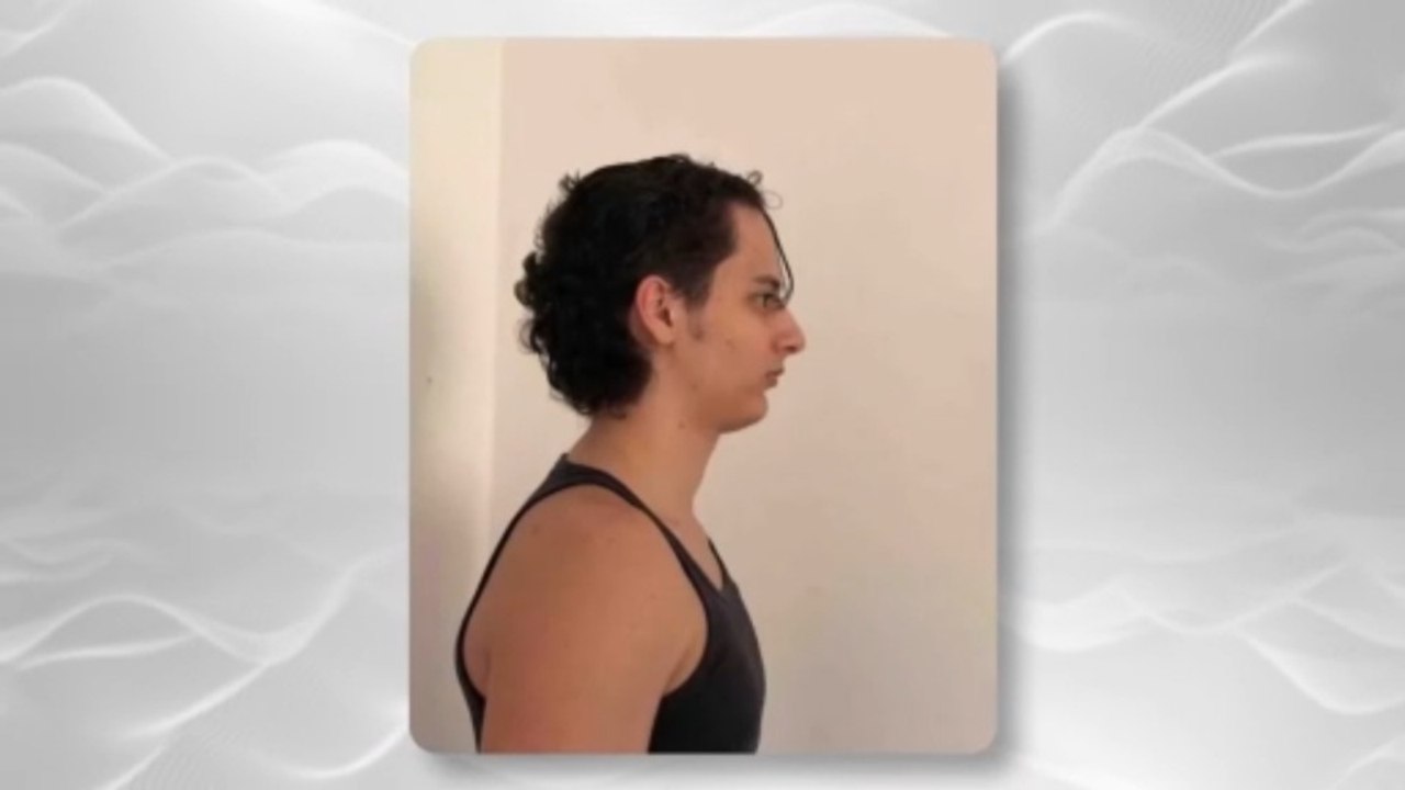 Why Your Face Looks Pushed Forward (And How to Fix It) - video Dailymotion