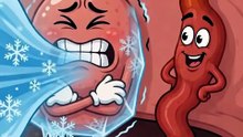 What causes brain freeze