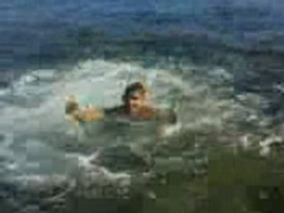 Salto nico grave