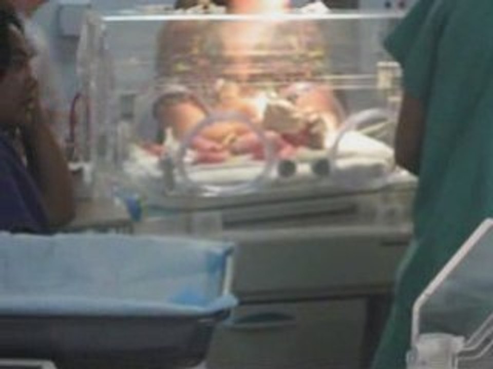 Twins, Day 1