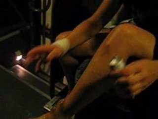 les conséquences d'une chute à la sortie d'un tgv