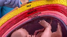 A Simple Visualization Of A C-Section