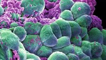 Mesothelioma Lawyers & Lawsuits In the USA_edit1