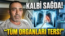 Tüm organları ters yerde  İHA