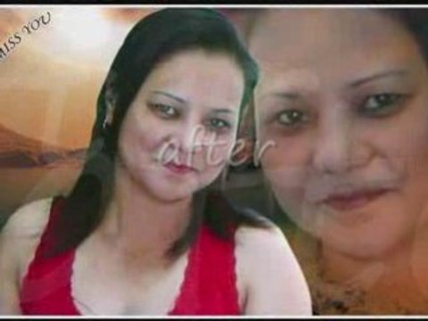 All about SKIN LIGHTENING skin bleaching SKIN WHITENING