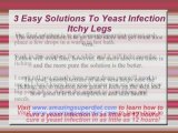3 Easy Solutions To Yeast Infection Itchy Legs