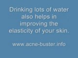 Clear Acne Tip No. 3 - Drink lots of Water