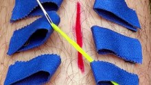 Emergency wound patching method