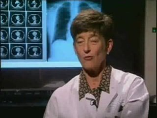 Lung Cancer Screening at Emory