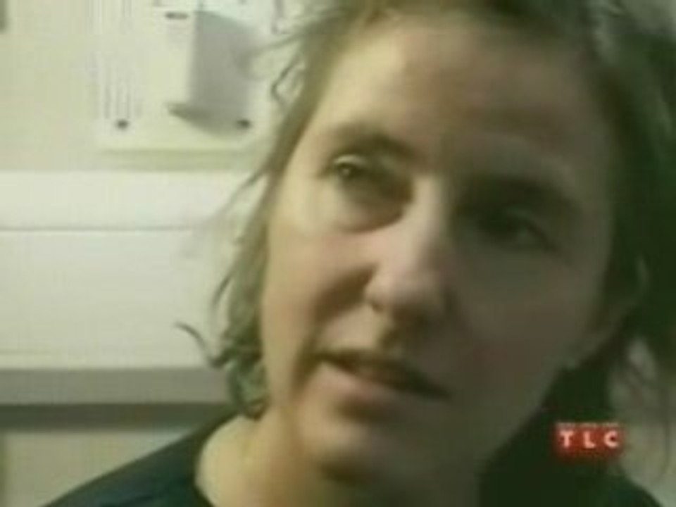 Choc sur Impressionnant.net   Un Vers vivant dans la tete