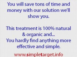 How do to Remove Genital Warts at Home