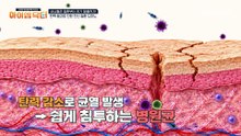 장기가 늘어지고 처진다?! 탄력 붕괴 증후군이 생기는 원인은?