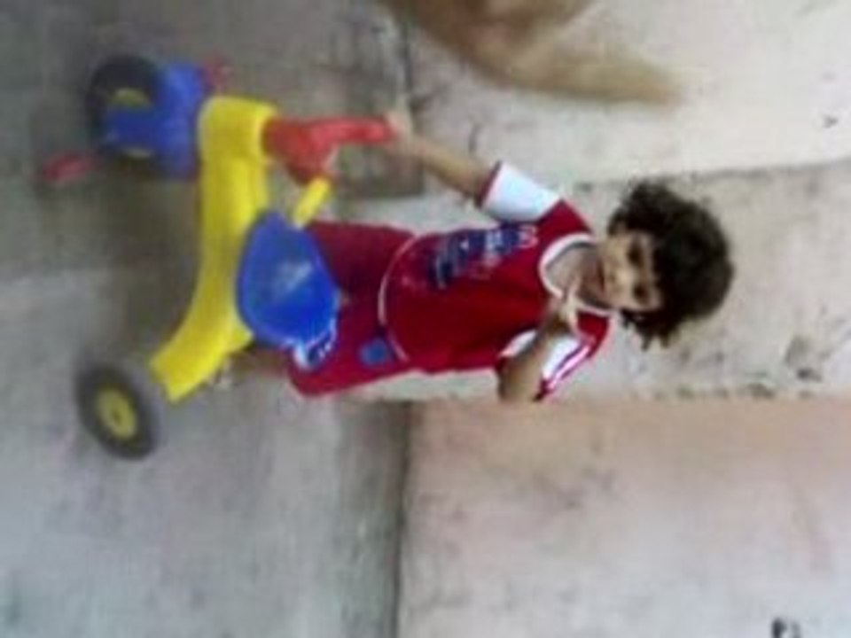 Anas (first extreme) 2.5 years old