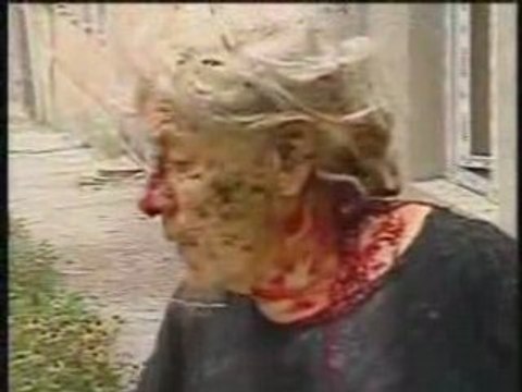 Russian War Crimes in Georgia Part 2