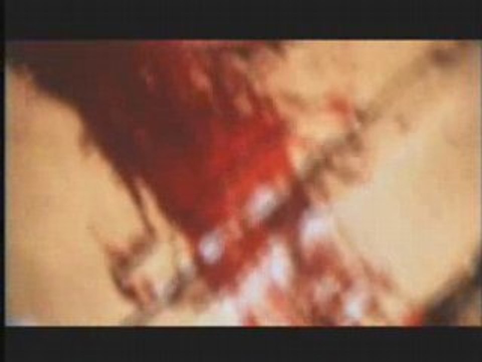 Unsane - Sick