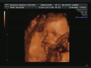 Notre petit bout jo jean ernest damien jessy