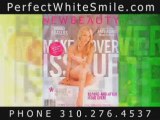 Beverly Hills Cosmetic Dentist Porcelain Veneers