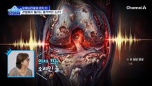 스1) 아팠던 관절이 더 아프다! 명절 직후 관절염 통증 비상?!