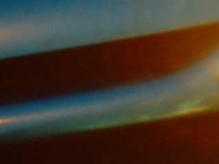 Bruit kit admission 206