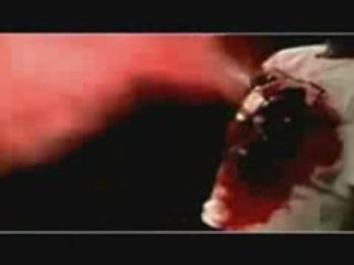 Despo rutti-arretez