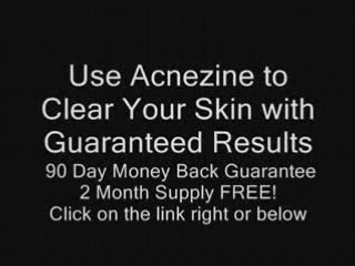 Acne Skin Care Products