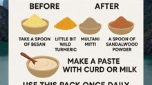 acne prone skin