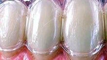 🦷✨ How Clear Aligners REALLY Move Your Teeth (No Metal Brackets!) 😱🔥