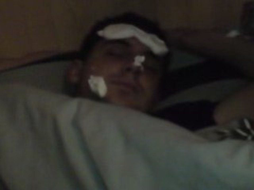 Mousse sur manu