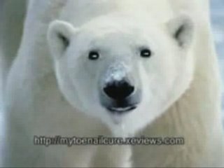 Top Toenail Fungus Cures