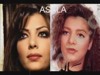 Chanteuses et actrices arabes avant et apres la chirurgie
