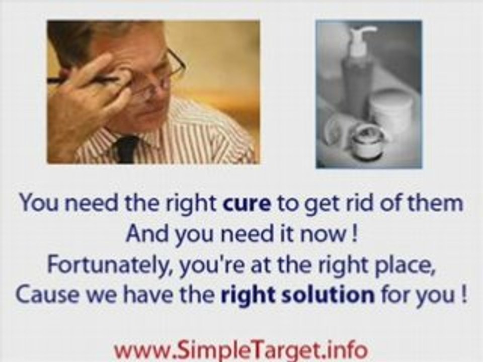 Ways to get rid of genital warts