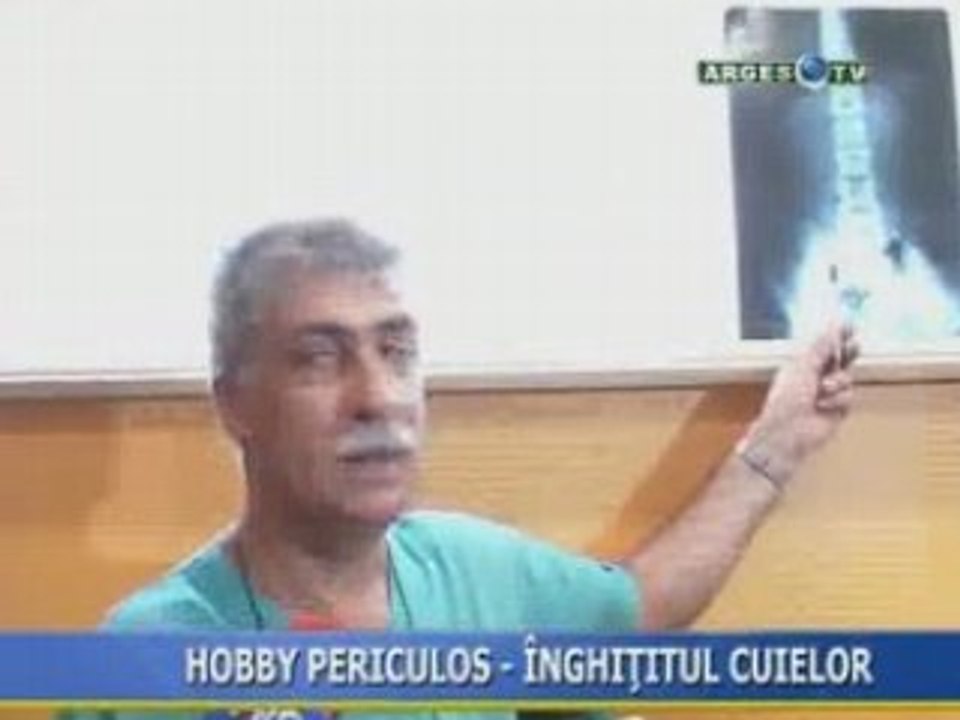 Hobby periculos -  inghititul cuielor